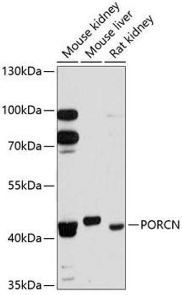 Anti-PORCN Antibody (CAB12250)