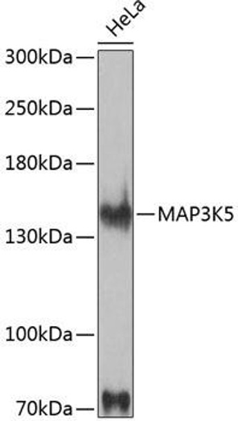 Anti-MAP3K5 Antibody (CAB12458)