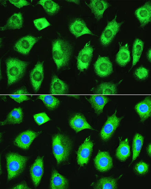 Anti-YTHDF1 Antibody (CAB13260)