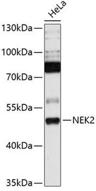 Anti-NEK2 Antibody (CAB13334)