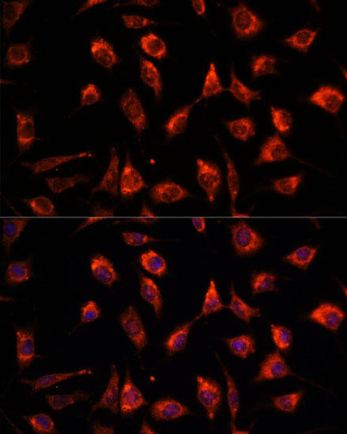 Anti-TPT1 Antibody (CAB13367)