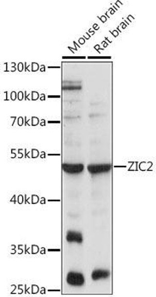 Anti-ZIC2 Antibody (CAB15736)