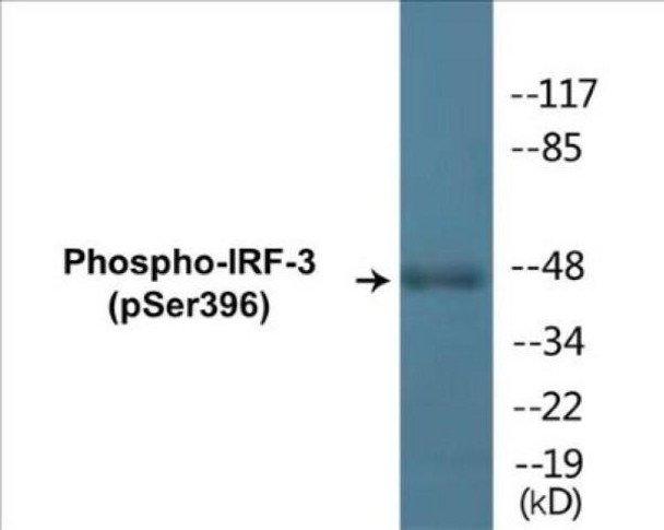 IRF-3 (Phospho-Ser396)Fluorometric Cell-Based ELISA Kit (FBCAB00041)