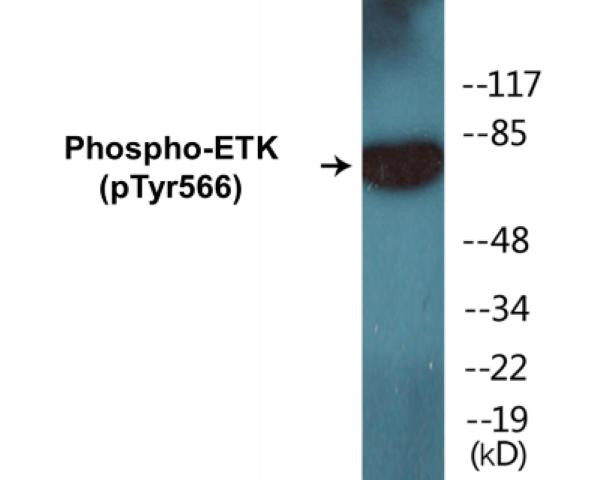 ETK (Phospho-Tyr566)Fluorometric Cell-Based ELISA Kit (FBCAB00046)