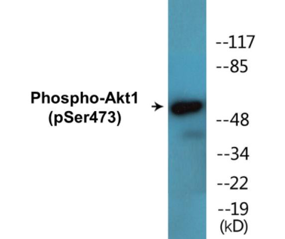 Akt1 (Phospho-Ser473)Fluorometric Cell-Based ELISA Kit (FBCAB00059)