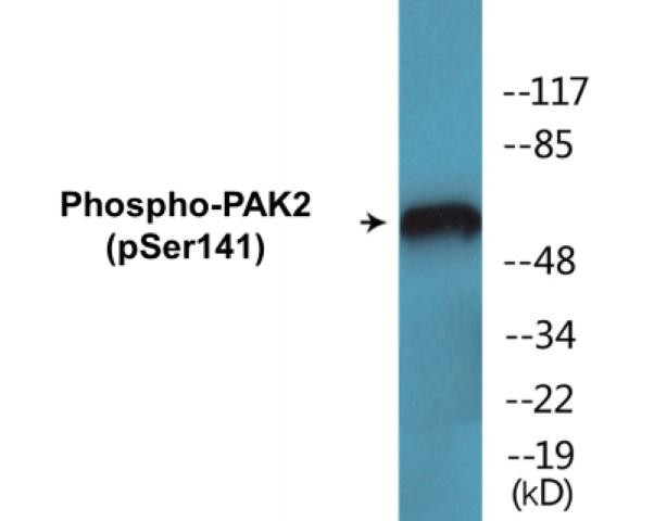 PAK2 (Phospho-Ser141)Fluorometric Cell-Based ELISA Kit (FBCAB00090)