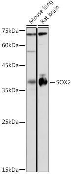 [KO Validated] SOX2 Rabbit Polyclonal Antibody (CAB0561)