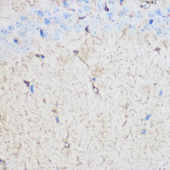 S100B Rabbit Polyclonal Antibody (CAB0676)