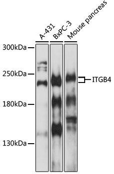 Integrin beta 4 (ITGB4/CD104) Rabbit Polyclonal Antibody (CAB0857)