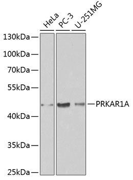 PRKAR1A Rabbit Polyclonal Antibody (CAB0906)