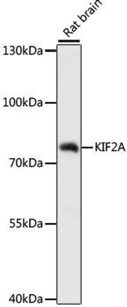 Anti-KIF2A Antibody (CAB16392)