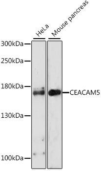 CEACAM5 Rabbit Polyclonal Antibody (CAB0970)