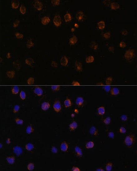 MyD88 Rabbit Polyclonal Antibody (CAB0980)