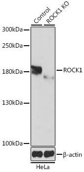 [KO Validated] ROCK1 Rabbit Polyclonal Antibody (CAB1008)