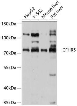 CFHR5 Rabbit Polyclonal Antibody (CAB10367)