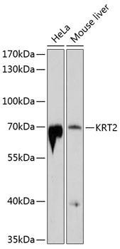 KRT2 Rabbit Polyclonal Antibody (CAB10375)