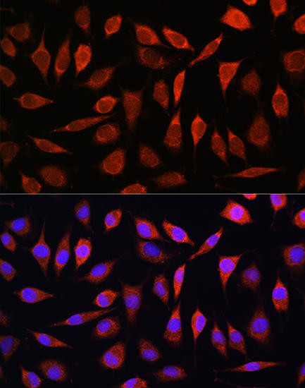 ZIP8 Rabbit Polyclonal Antibody (CAB10395)