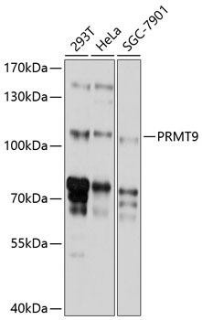 PRMT9 Rabbit Polyclonal Antibody (CAB10491)