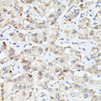 PLIN3 Rabbit Polyclonal Antibody (CAB1050)