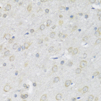 P2RX7 Rabbit Polyclonal Antibody (CAB10511)