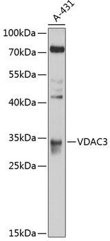 VDAC3 Rabbit Polyclonal Antibody (CAB10544)