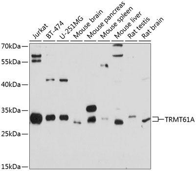 TRMT61A Rabbit Polyclonal Antibody (CAB10597)