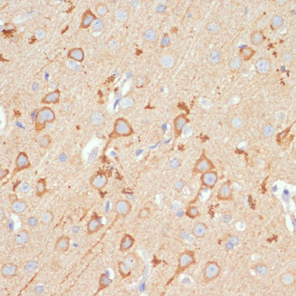 Anti-GRIA1 Antibody (CAB1826)