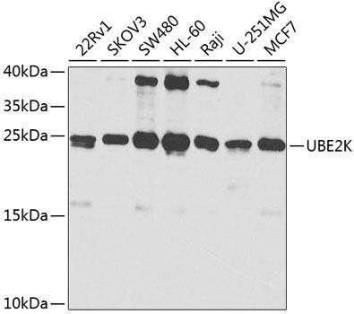 UBE2K Rabbit Polyclonal Antibody (CAB1086)