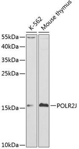 Anti-POLR2J Antibody (CAB1843)