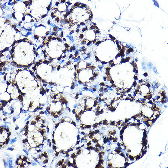 PPARγ Rabbit Polyclonal Antibody (CAB11183)