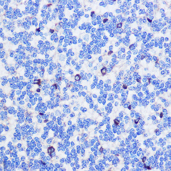 ASC/TMS1 Rabbit Polyclonal Antibody (CAB11433)