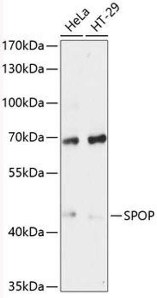 SPOP Rabbit Polyclonal Antibody (CAB12106)