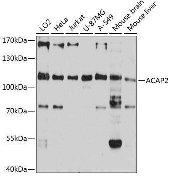 ACAP2 Rabbit Polyclonal Antibody (CAB12127)