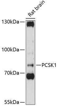 PCSK1 Rabbit Polyclonal Antibody (CAB12237)