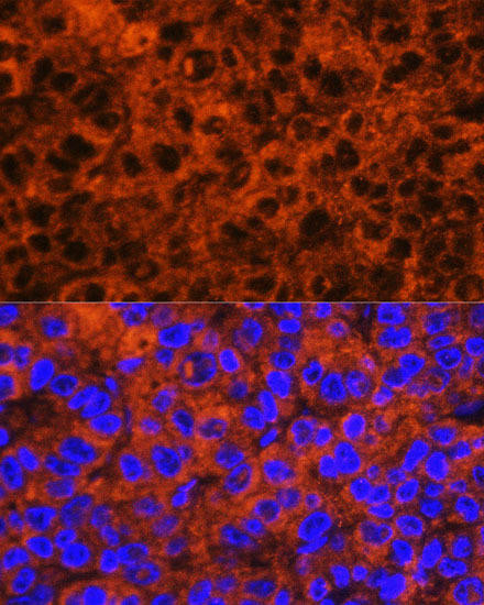F2 Rabbit Polyclonal Antibody (CAB12382)
