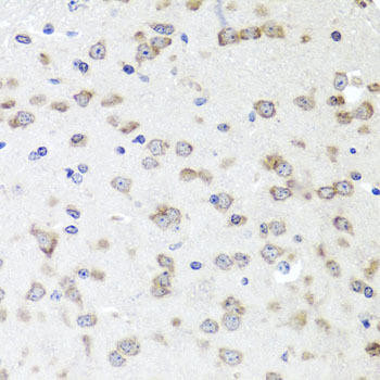IGFBP5 Rabbit Polyclonal Antibody (CAB12451)