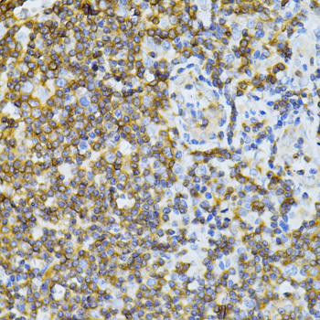 MT-ND5 Rabbit Polyclonal Antibody (CAB12465)