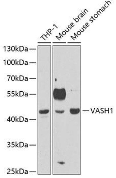 Anti-VASH1 Antibody (CAB6148)