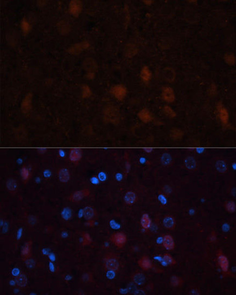 Anti-GRIN1 Antibody (CAB7167)