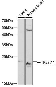 TP53I11 Rabbit Polyclonal Antibody (CAB12855)