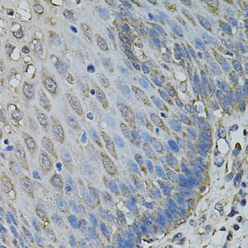 IL1A Rabbit Polyclonal Antibody (CAB1316)