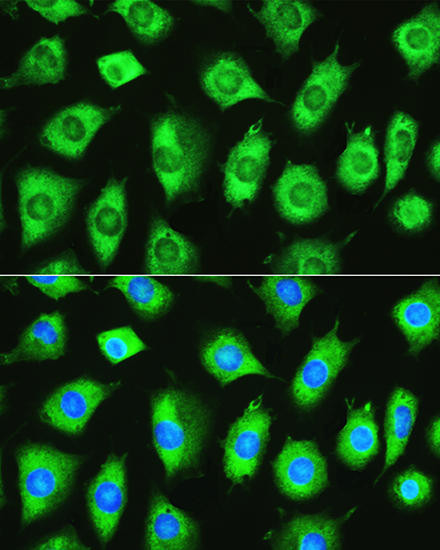 Anti-YTHDF1 Antibody (CAB13260)