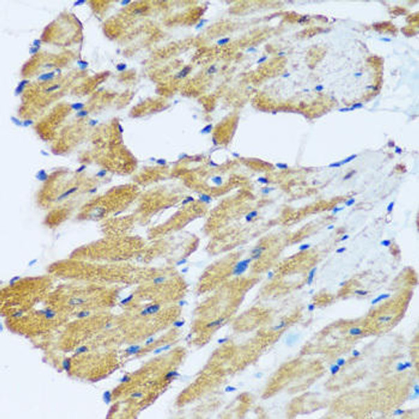 Anti-ARHGEF5 Antibody (CAB17014)