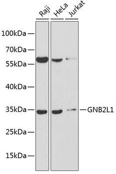 RACK1 Rabbit Polyclonal Antibody (CAB13393)