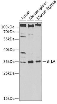 BTLA Rabbit Polyclonal Antibody (CAB13449)