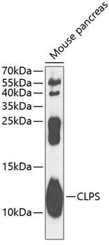 CLPS Rabbit Polyclonal Antibody (CAB13480)