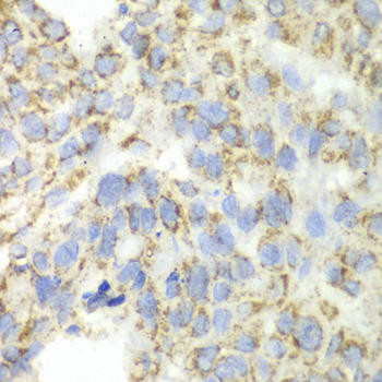 ALDH4A1 Rabbit Polyclonal Antibody (CAB13569)