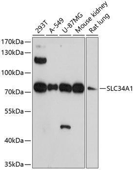 SLC34A1 Rabbit Polyclonal Antibody (CAB13635)