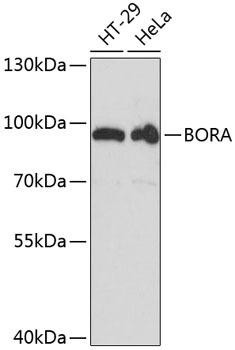 BORA Rabbit Polyclonal Antibody (CAB13847)