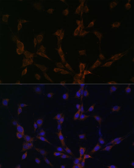 DYNLL2 Rabbit Polyclonal Antibody (CAB13888)